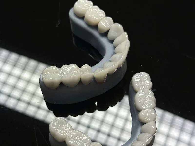 Facetas de porcelana sobre modelo dentário