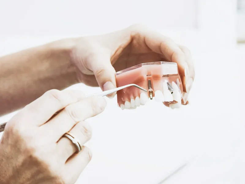 Prótese dentária parcial sendo examinada em mãos
